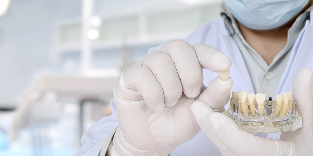 Riesgos en implantes dentales