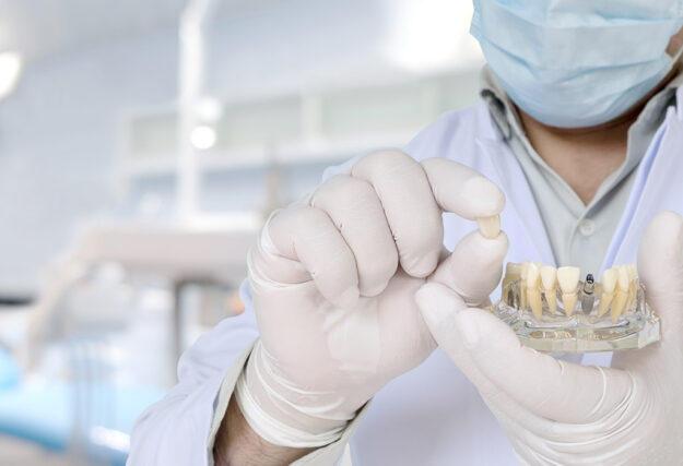 Riesgos en implantes dentales